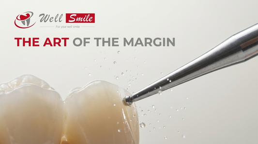 The Art of the Margin: Why Micron-Level Precision Defines Restoration Longevity