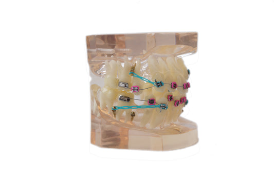 Orthodontic Study Models and Modern Orthodontics