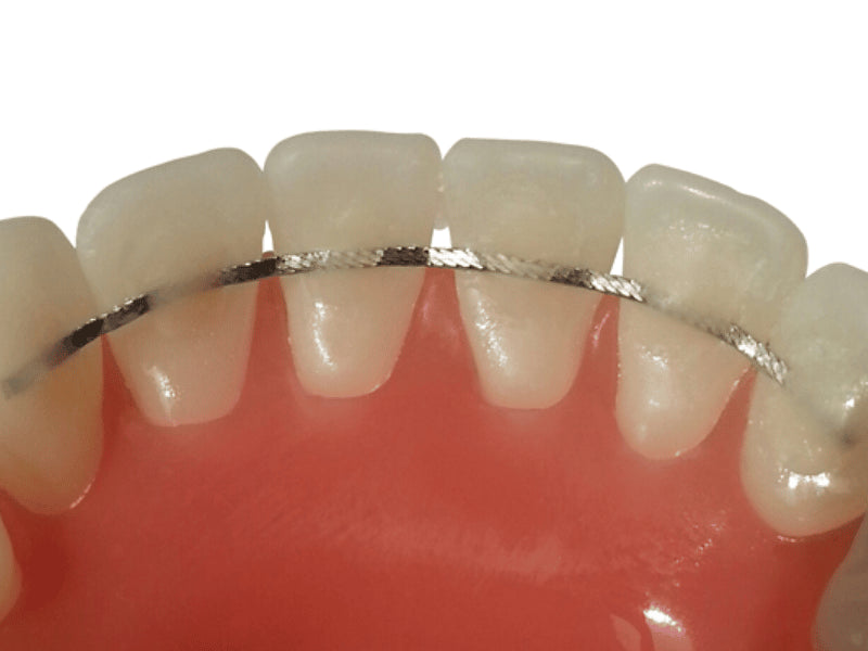 10 Pcs Orthodontic Flat Stainless Steel Retainer wire1