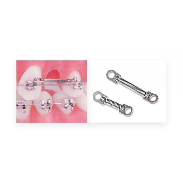 Orthodontic closed spring application