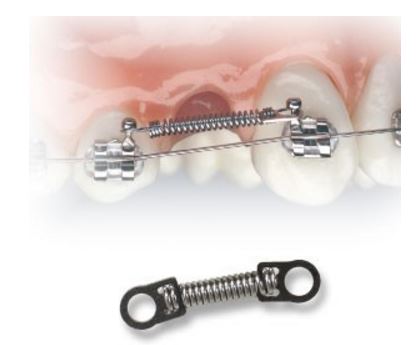 Orthodontic closed spring short