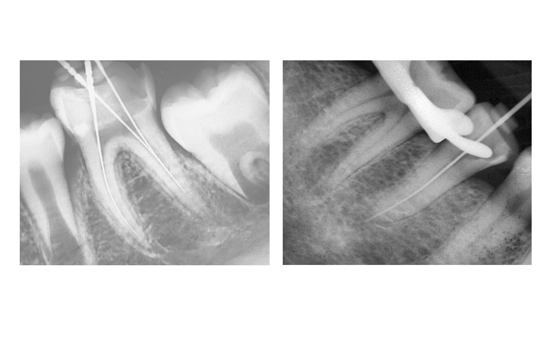 Smile A Lot Portable Dental X-Ray RVG Sensor