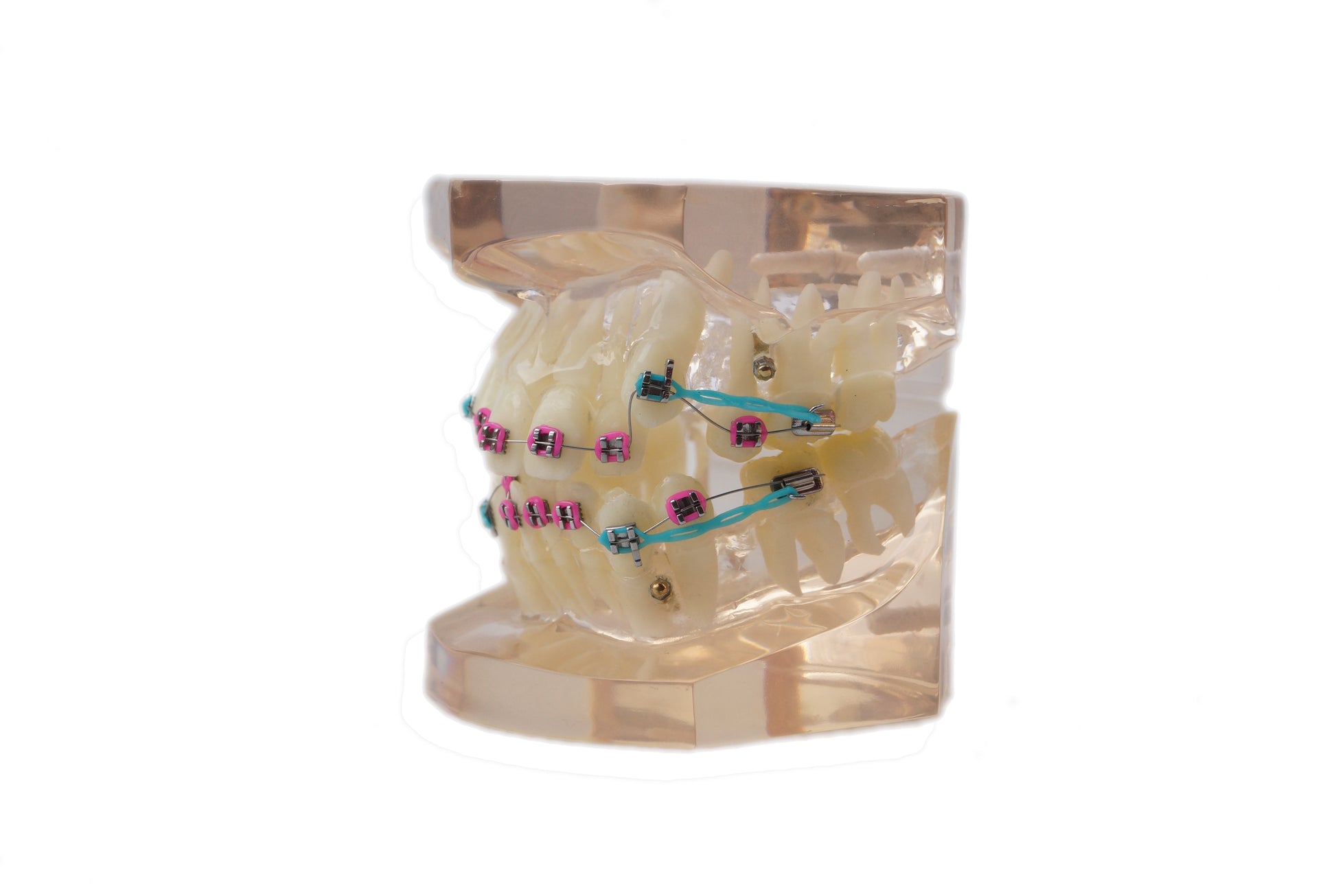 Standard orthodontic tooth model