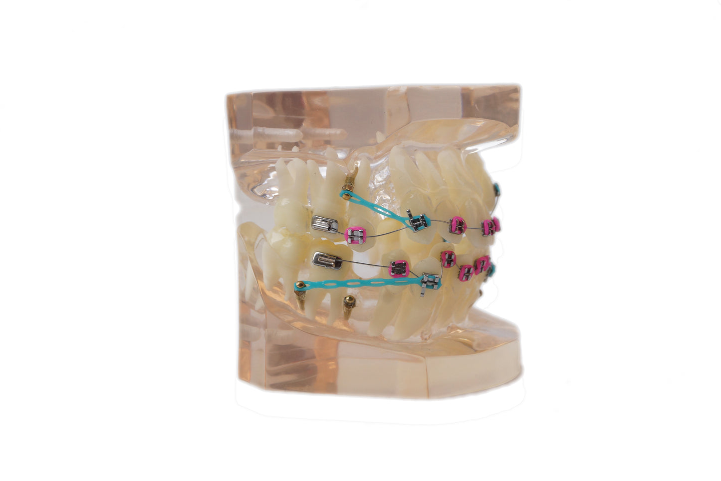 Standard orthodontic tooth model0