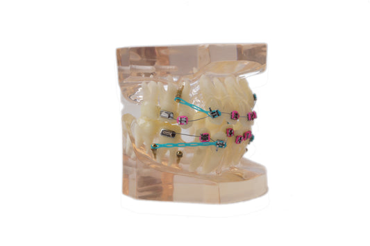 Standard orthodontic tooth model0