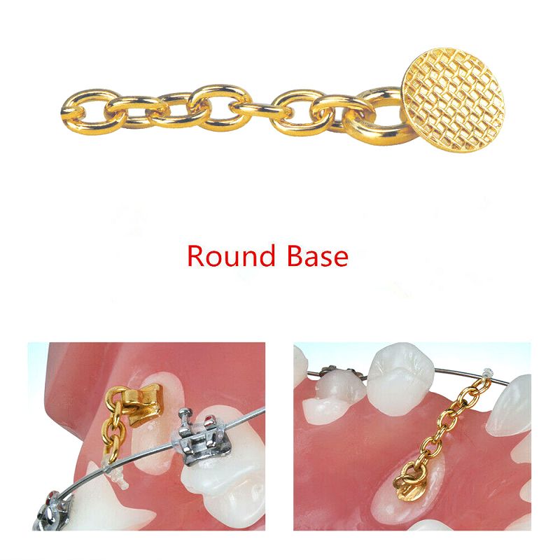 Dental Orthodontic Button Chain 10 pcs – Round Base, Gold & Silver, Flexible Traction for Impacted Cuspids